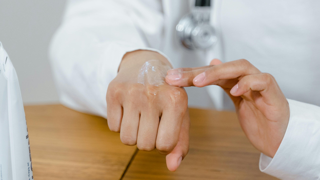 A doctor in a white coat applies a small amount of clear topical cream or gel to the back of their hand, demonstrating its use.