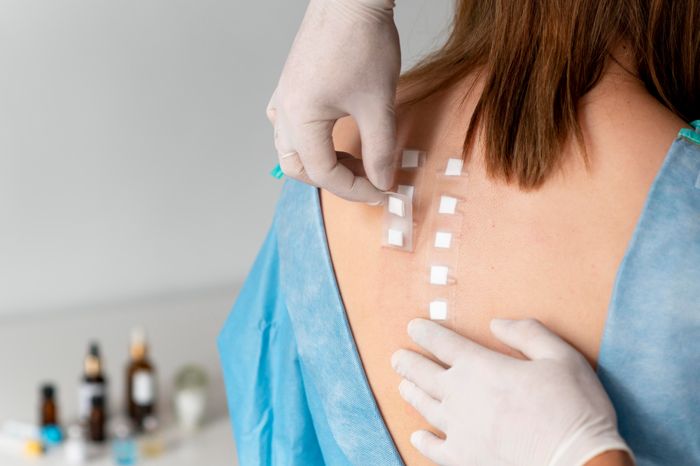Close-up of a patient's back where a doctor, wearing white gloves, is applying or removing a series of small square patches for a skin allergy patch test.
